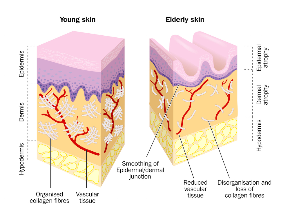 collagen peptides, vital proteins collagen peptides, vital proteins, collagen, collagen supplements, hydrolyzed collagen, collagen protein, collagen drink, collagen peptide, collagen hydrolysate, pure collagen, collagen for skin